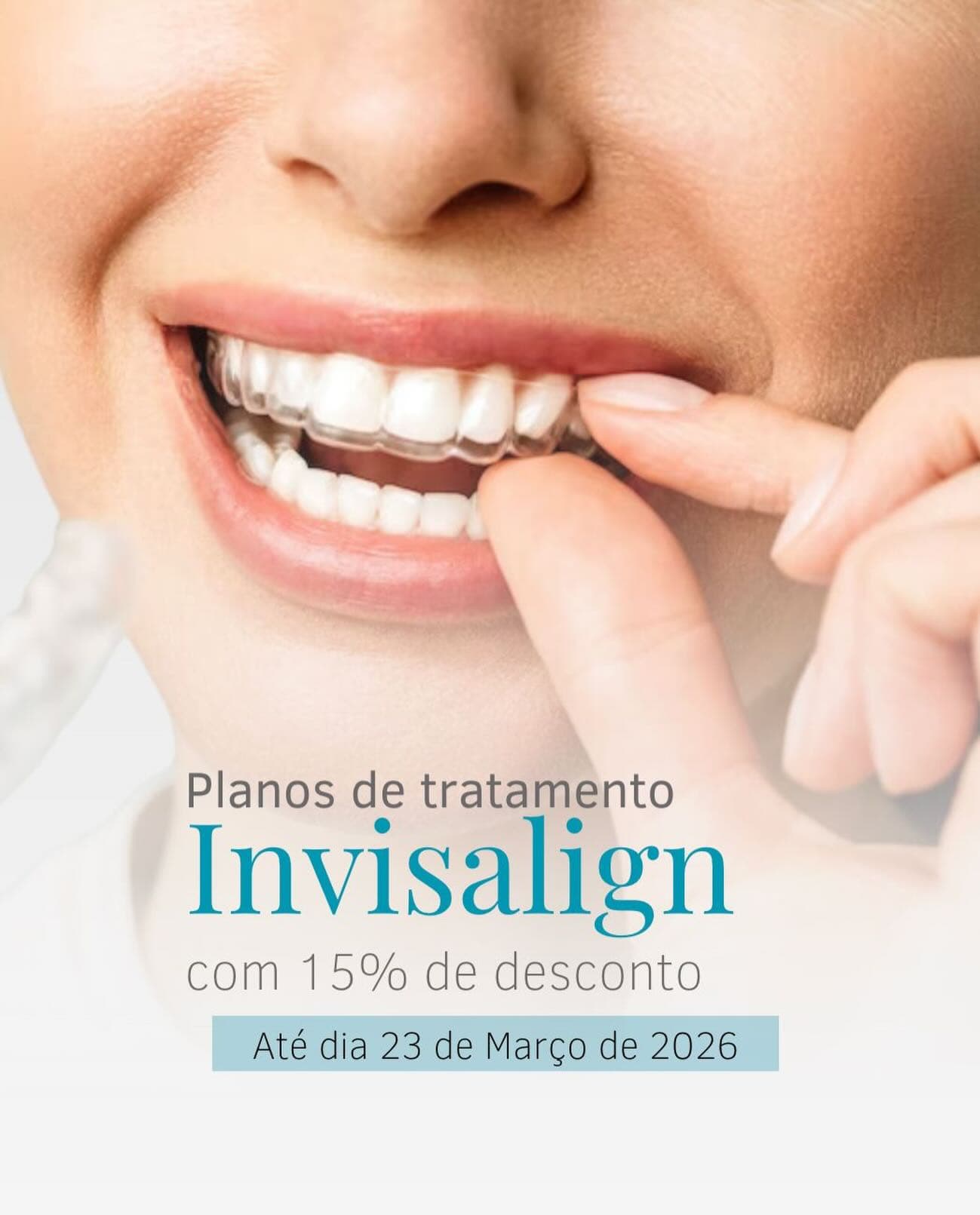 Depois — Resultado real